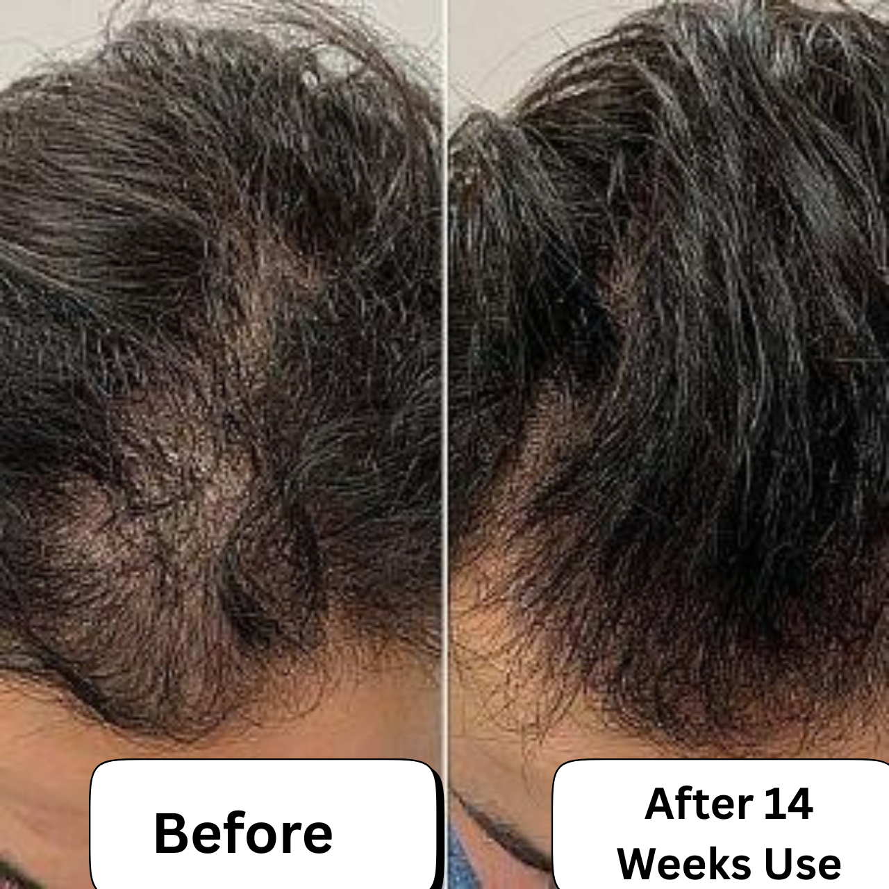 STEM-X    Advanced Stem Cell Therapy Hair Renewal Serum